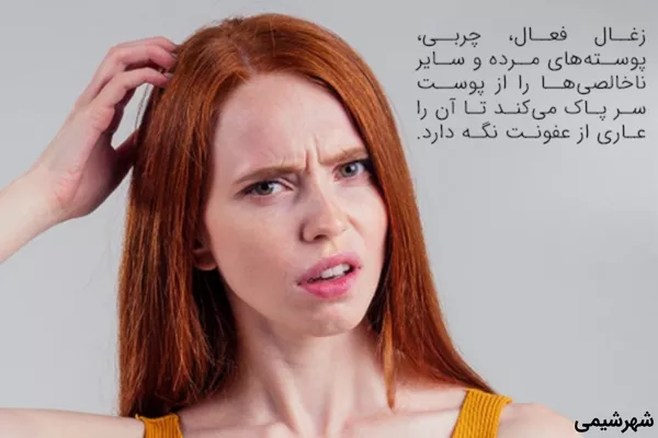 استفاده از زغال فعال برای درمان شوره سر و خارش پوست سر