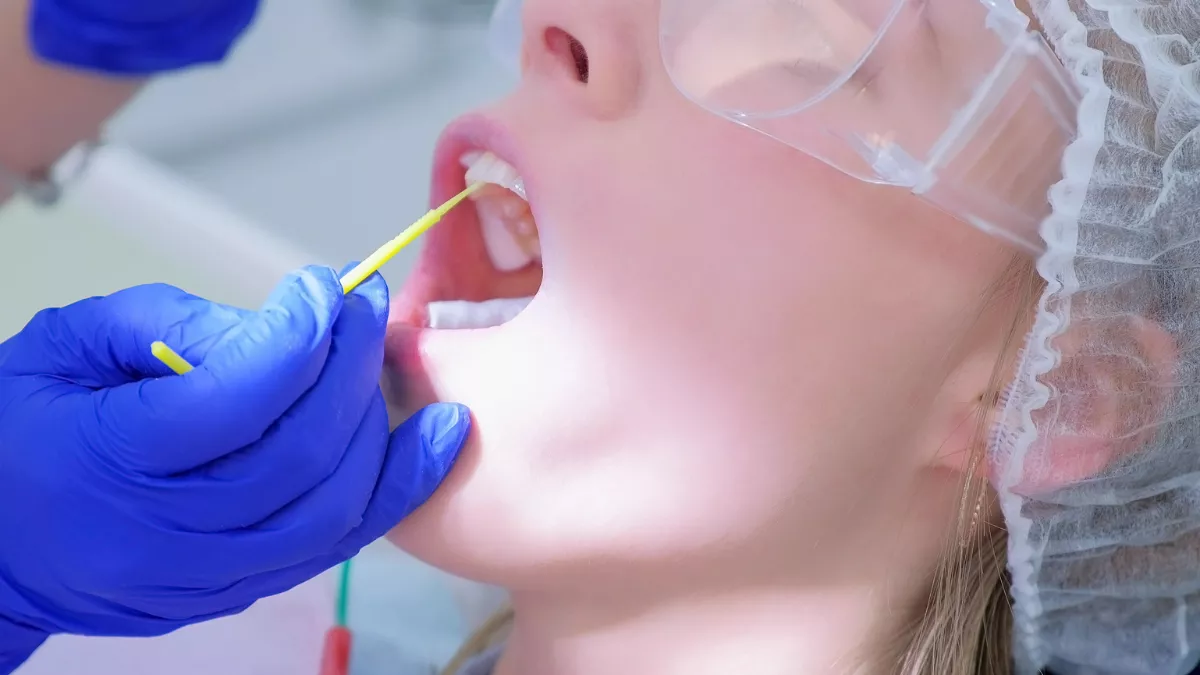 وارنیش سدیم فلوراید